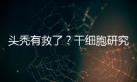 头秃有救了？干细胞研究阐明压力如何影响毛发生长